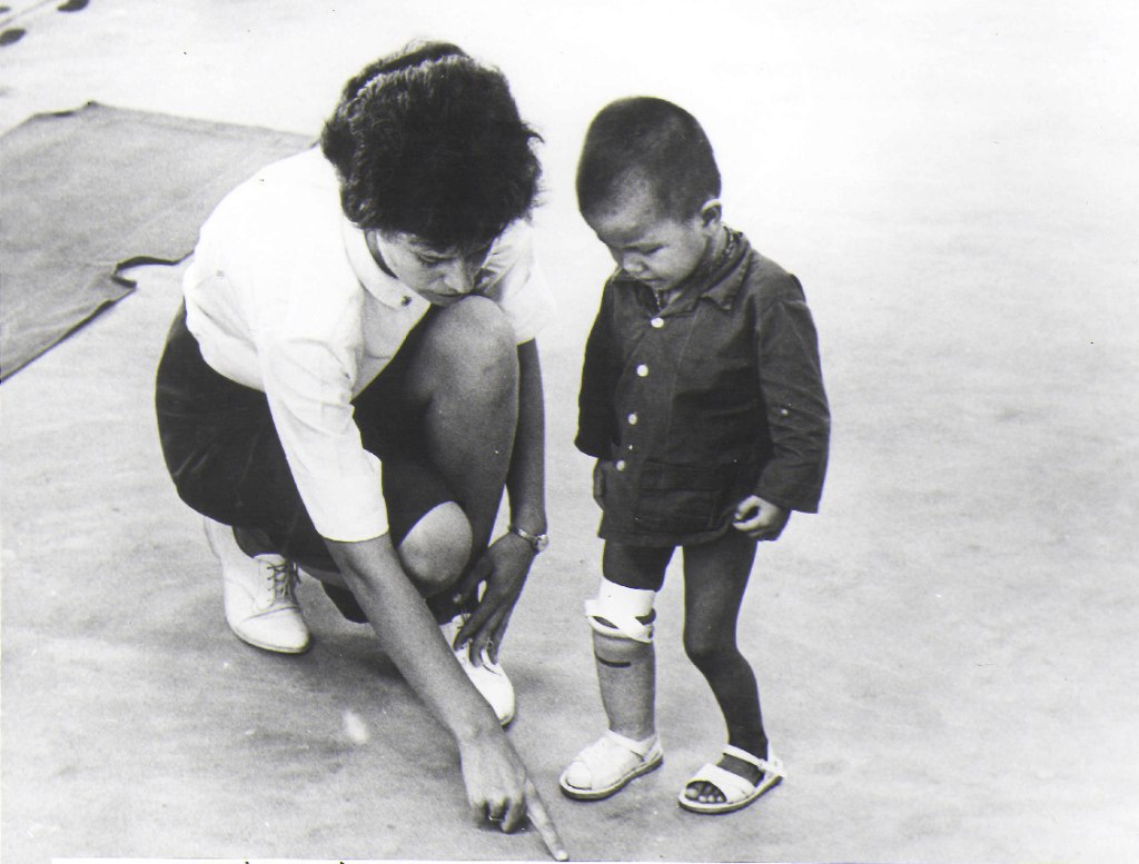 Woman helping a child walk with an artificial leg